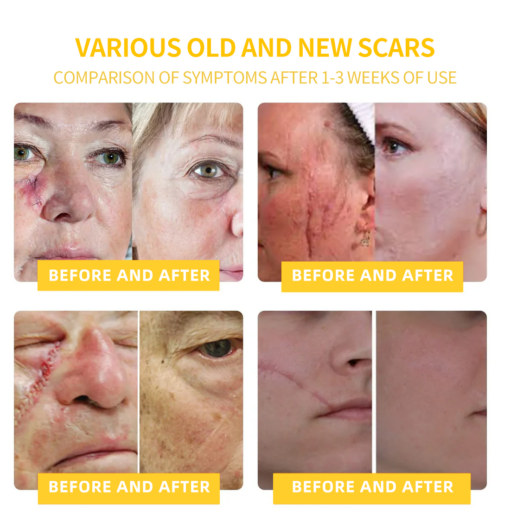 LOVILDS⢠Bee Toxin Skin Repair Cream(AAD Recommendedđ¨ââď¸)