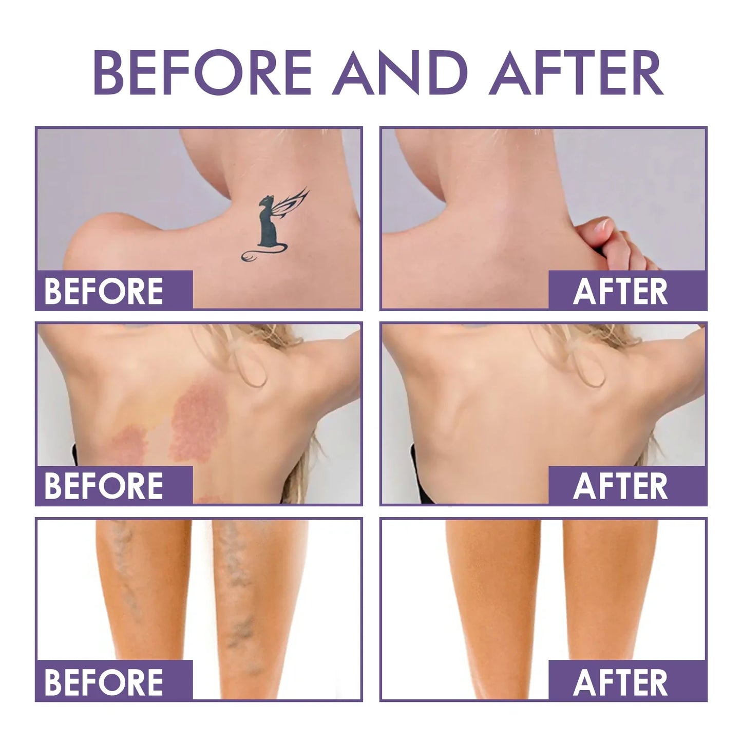 🔥 Final 3 Hours! 75% Off 🌸LOVILDS  Body Perfector