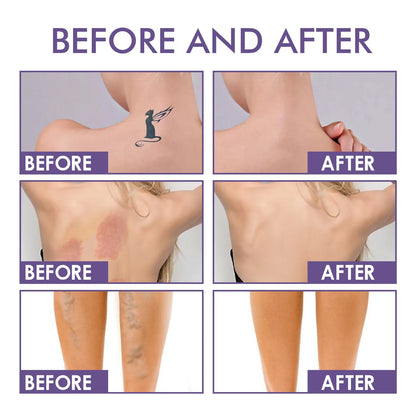 🔥 Final 3 Hours! 75% Off 🌸LOVILDS  Body Perfector
