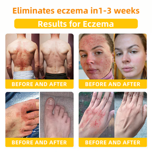 LOVILDS™ Bee Toxin Skin Repair Cream(AAD Recommended👨‍⚕️)