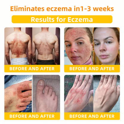 LOVILDS™ Bee Toxin Skin Repair Cream(AAD Recommended👨‍⚕️)